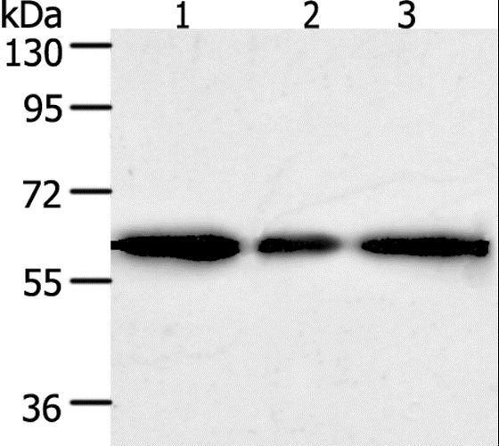 AKR1A1 Antibody - Western blot analysis of Human liver cancer tissue, HeLa and 293T cell, using AKR1A1 Polyclonal Antibody at dilution of 1:500.