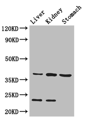 AKR1A1 Antibody - Positive WB detected in:Mouse liver tissue,Mouse kidney tissue,Mouse stomach tissue;All lanes: Akr1a1 antibody at 2.8ug/ml;Secondary;Goat polyclonal to rabbit IgG at 1/50000 dilution;Predicted band size: 37 kDa;Observed band size: 37,23 kDa;