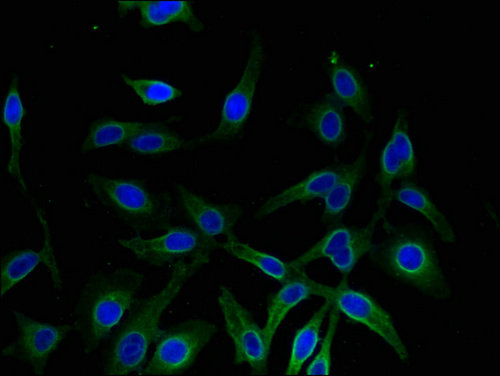 AKR1A1 Antibody - Immunofluorescent analysis of Hela cells using AKR1A1 Antibody at a dilution of 1:100 and Alexa Fluor 488-congugated AffiniPure Goat Anti-Rabbit IgG(H+L)
