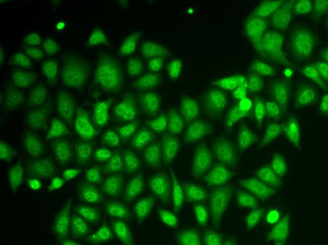 AKR1A1 Antibody - Immunofluorescence analysis of HeLa cells using AKR1A1 antibody.