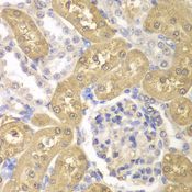 AKR1A1 Antibody - Immunohistochemistry of paraffin-embedded rat kidney using AKR1A1 antibody at dilution of 1:100 (40x lens).