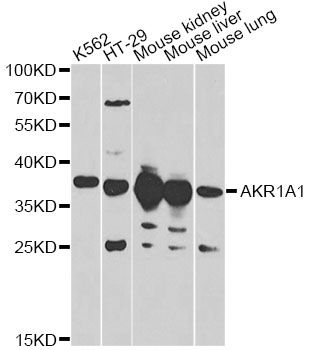 AKR1A1 Antibody - Western blot analysis of extracts of various cell lines, using AKR1A1 antibody at 1:1000 dilution. The secondary antibody used was an HRP Goat Anti-Rabbit IgG (H+L) at 1:10000 dilution. Lysates were loaded 25ug per lane and 3% nonfat dry milk in TBST was used for blocking.