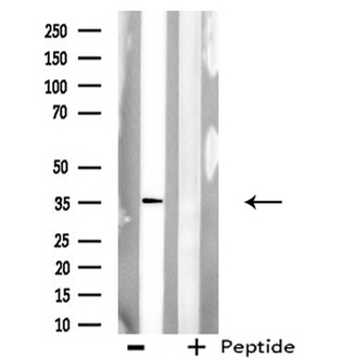 AKR1A1 Antibody - Western blot analysis of extracts of COLO205 cells using AKR1A1 antibody.