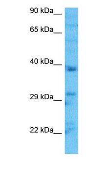 AKR1A1 Antibody - Western blot of AKR1A1 Antibody with human HepG2 Whole Cell lysate.  This image was taken for the unconjugated form of this product. Other forms have not been tested.