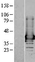 AKR1A1 Protein - Western validation with an anti-DDK antibody * L: Control HEK293 lysate R: Over-expression lysate