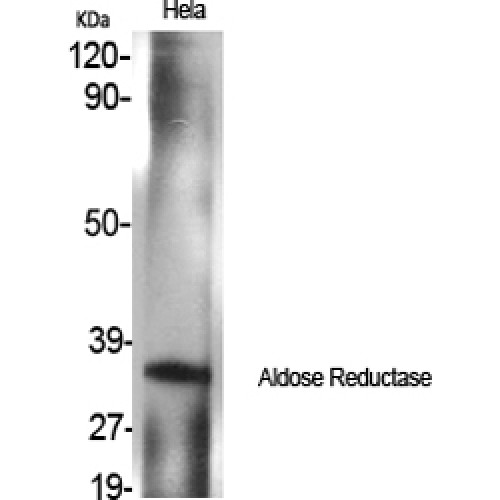 AKR1B1 / Aldose Reductase Antibody - Western blot of Aldose Reductase antibody