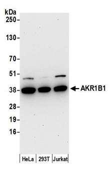 AKR1B1 / Aldose Reductase Antibody - Detection of human AKR1B1 by western blot. Samples: Whole cell lysate (50 µg) from HeLa, HEK293T, and Jurkat cells prepared using NETN lysis buffer. Antibody: Affinity purified rabbit anti-AKR1B1 antibody used for WB at 0.1 µg/ml. Detection: Chemiluminescence with an exposure time of 30 seconds.