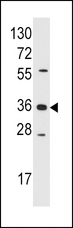 AKR1B1 / Aldose Reductase Antibody - Western blot of anti-AKR1B1 antibody in Jurkat cell line lysates (35 ug/lane). AKR1B1 (arrow) was detected using the purified antibody.