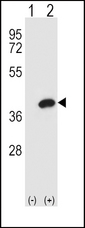 AKR1B1 / Aldose Reductase Antibody - Western blot of AKR1B1 (arrow) using rabbit polyclonal AKR1B1 Antibody. 293 cell lysates (2 ug/lane) either nontransfected (Lane 1) or transiently transfected (Lane 2) with the AKR1B1 gene.