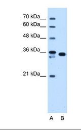 AKR1B1 / Aldose Reductase Antibody - Lane A: Marker. Lane B: HepG2 cell lysate. Antibody concentration: 1.25 ug/ml. Gel concentration: 12%.  This image was taken for the unconjugated form of this product. Other forms have not been tested.