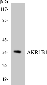 AKR1B1 / Aldose Reductase Antibody - Western blot analysis of the lysates from HUVECcells using AKR1B1 antibody.