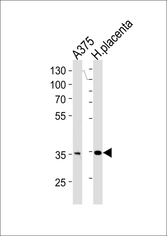 AKR1B1 / Aldose Reductase Antibody - AKR1B1 Antibody western blot of A375 cell line and human placenta tissue lysates (35 ug/lane). The AKR1B1 antibody detected the AKR1B1 protein (arrow).