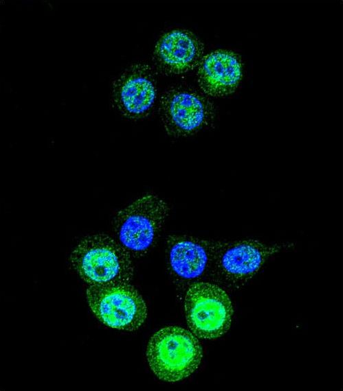 AKR1B1 / Aldose Reductase Antibody - Confocal immunofluorescence of AKR1B1 Antibody with 293 cell followed by Alexa Fluor 488-conjugated goat anti-rabbit lgG (green). DAPI was used to stain the cell nuclear (blue).