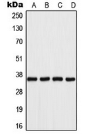 AKR1B1 / Aldose Reductase Antibody - Western blot analysis of Aldose Reductase expression in Jurkat (A); HeLa (B); SP2/0 (C); PC12 (D) whole cell lysates.