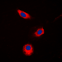 AKR1B1 / Aldose Reductase Antibody - Immunofluorescent analysis of Aldose Reductase staining in Jurkat cells. Formalin-fixed cells were permeabilized with 0.1% Triton X-100 in TBS for 5-10 minutes and blocked with 3% BSA-PBS for 30 minutes at room temperature. Cells were probed with the primary antibody in 3% BSA-PBS and incubated overnight at 4 C in a humidified chamber. Cells were washed with PBST and incubated with a DyLight 594-conjugated secondary antibody (red) in PBS at room temperature in the dark. DAPI was used to stain the cell nuclei (blue).