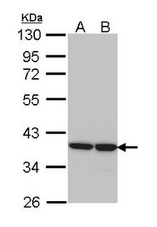 AKR1B1 / Aldose Reductase Antibody - Sample (30 ug of whole cell lysate). A: 293T. B: A431. 10% SDS PAGE. AKR1B1 antibody diluted at 1:1000. 