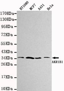 AKR1B1 / Aldose Reductase Antibody - Western blot detection of AKR1B1 in HT1080,MCF7,A431&Hela cell lysates using AKR1B1 antibody (1:1000 diluted).