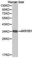 AKR1B1 / Aldose Reductase Antibody - Western blot of extracts of human liver cell lines, using AKR1B1 antibody.