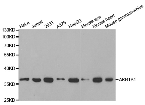 AKR1B1 / Aldose Reductase Antibody - Western blot analysis of extracts of various cell lines, using AKR1B1 antibody at 1:1000 dilution. The secondary antibody used was an HRP Goat Anti-Rabbit IgG (H+L) at 1:10000 dilution. Lysates were loaded 25ug per lane and 3% nonfat dry milk in TBST was used for blocking.