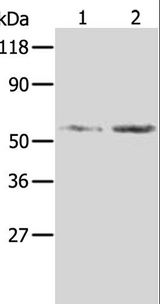 AKR1B1 / Aldose Reductase Antibody - Western blot analysis of HeLa and 293T cell, using AKR1B1 Polyclonal Antibody at dilution of 1:350.