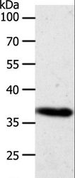 AKR1B1 / Aldose Reductase Antibody - Western blot analysis of HeLa cell, using AKR1B1 Polyclonal Antibody at dilution of 1:700.