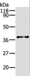 AKR1B1 / Aldose Reductase Antibody - Western blot analysis of HeLa cell, using AKR1B1 Polyclonal Antibody at dilution of 1:340.