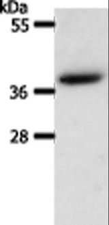 AKR1B1 / Aldose Reductase Antibody - Western blot analysis of HeLa cell, using AKR1B1 Polyclonal Antibody at dilution of 1:550.
