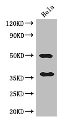 AKR1B1 / Aldose Reductase Antibody - Positive WB detected in:Hela whole cell lysate;All lanes: AKR1B1 antibody at 3ug/ml;Secondary;Goat polyclonal to rabbit IgG at 1/50000 dilution;Predicted band size: 36 kDa;Observed band size: 36,50 kDa;
