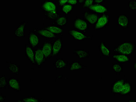 AKR1B1 / Aldose Reductase Antibody - Immunofluorescent analysis of A549 cells using AKR1B1 Antibody at a dilution of 1:100 and Alexa Fluor 488-congugated AffiniPure Goat Anti-Rabbit IgG(H+L)