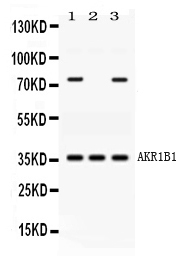 AKR1B1 / Aldose Reductase Antibody - Western blot - Anti-AKR1B1 Picoband Antibody