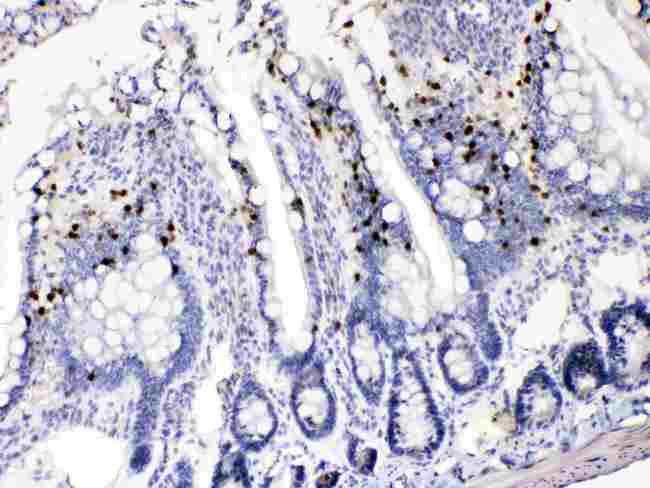 AKR1B1 / Aldose Reductase Antibody - AKR1B1 was detected in paraffin-embedded sections of rat intestine tissues using rabbit anti- AKR1B1 Antigen Affinity purified polyclonal antibody