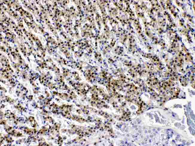AKR1B1 / Aldose Reductase Antibody - AKR1B1 was detected in paraffin-embedded sections of rat adrenal gland tissues using rabbit anti- AKR1B1 Antigen Affinity purified polyclonal antibody