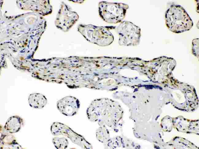 AKR1B1 / Aldose Reductase Antibody - AKR1B1 was detected in paraffin-embedded sections of human placenta tissues using rabbit anti- AKR1B1 Antigen Affinity purified polyclonal antibody