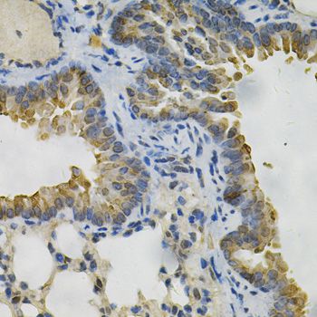AKR1B1 / Aldose Reductase Antibody - Immunohistochemistry of paraffin-embedded mouse lung using AKR1B1 Antibody at dilution of 1:100 (40x lens).