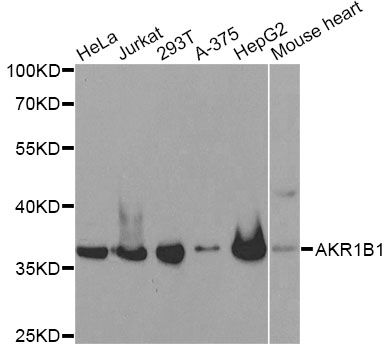 AKR1B1 / Aldose Reductase Antibody - Western blot analysis of extracts of various cell lines, using AKR1B1 antibody at 1:1000 dilution. The secondary antibody used was an HRP Goat Anti-Rabbit IgG (H+L) at 1:10000 dilution. Lysates were loaded 25ug per lane and 3% nonfat dry milk in TBST was used for blocking.