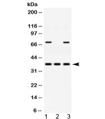 AKR1B1 / Aldose Reductase Antibody - Western blot testing of 1) rat heart, 2) human placenta and 3) human HeLa lysate with AKR1B1 antibody at 0.5ug/ml. Predicted molecular weight ~36 kDa.