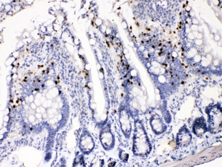 AKR1B1 / Aldose Reductase Antibody - IHC testing of FFPE rat intestine with AKR1B1 antibody at 1ug/ml. HIER: steam sections in pH6 citrate buffer for 20 min.