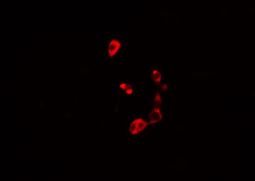 AKR1B1 / Aldose Reductase Antibody - Staining HuvEc cells by IF/ICC. The samples were fixed with PFA and permeabilized in 0.1% Triton X-100, then blocked in 10% serum for 45 min at 25°C. The primary antibody was diluted at 1:200 and incubated with the sample for 1 hour at 37°C. An Alexa Fluor 594 conjugated goat anti-rabbit IgG (H+L) antibody, diluted at 1/600, was used as secondary antibody.