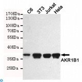 AKR1B1 / Aldose Reductase Antibody - Western blot detection of AKR1B1 in C6, 3T3, Jurkat and Hela cell lysates using AKR1B1 mouse mAb (1:1000 diluted). Predicted band size: 36KDa. Observed band size: 36KDa.