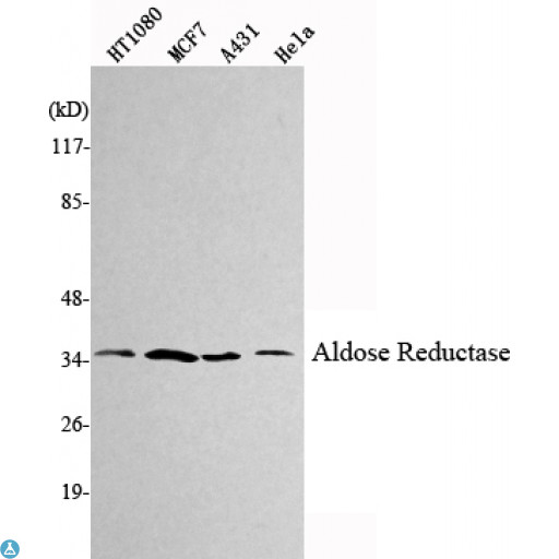 AKR1B1 / Aldose Reductase Antibody - Western Blot (WB) analysis using Aldose Reductase Monoclonal Antibody against HT1080, MCF7, A431, HeLa cell lysate.
