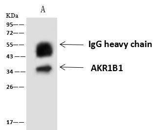 AKR1B1 / Aldose Reductase Antibody - AKR1B1 was immunoprecipitated using: Lane A: 0.5 mg HeLa Whole Cell Lysate. 4 uL anti-AKR1B1 rabbit polyclonal antibody and 60 ug of Immunomagnetic beads Protein A/G. Primary antibody: Anti-AKR1B1 rabbit polyclonal antibody, at 1:100 dilution. Secondary antibody: Goat Anti-Rabbit IgG (H+L)/HRP at 1/10000 dilution. Developed using the ECL technique. Performed under reducing conditions. Predicted band size: 36 kDa. Observed band size: 34 kDa.
