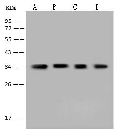 AKR1B1 / Aldose Reductase Antibody - Anti-AKR1B1 rabbit polyclonal antibody at 1:5000 dilution. Lane A: HeLa Whole Cell Lysate. Lane B: Jurkat Whole Cell Lysate. Lane C: 293T Whole Cell Lysate. Lane D: A431 Whole Cell Lysate. Lysates/proteins at 30 ug per lane. Secondary: Goat Anti-Rabbit IgG (H+L)/HRP at 1/10000 dilution. Developed using the ECL technique. Performed under reducing conditions. Predicted band size: 36 kDa. Observed band size: 36 kDa.