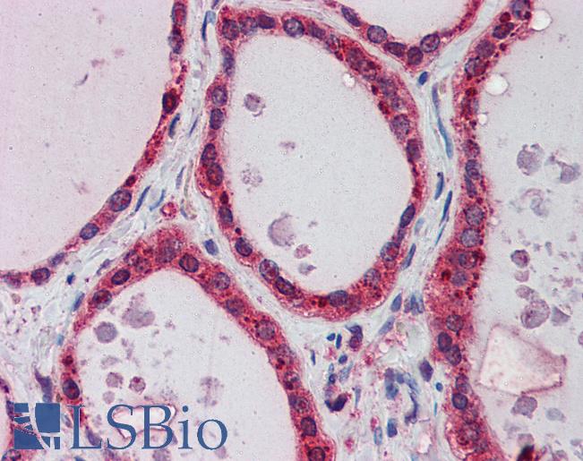 AKR1B1 / Aldose Reductase Antibody - Anti-AKR1B1 antibody IHC of human thyroid. Immunohistochemistry of formalin-fixed, paraffin-embedded tissue after heat-induced antigen retrieval. Antibody concentration 5 ug/ml.  This image was taken for the unconjugated form of this product. Other forms have not been tested.