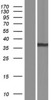 AKR1B1 / Aldose Reductase Protein - Western validation with an anti-DDK antibody * L: Control HEK293 lysate R: Over-expression lysate