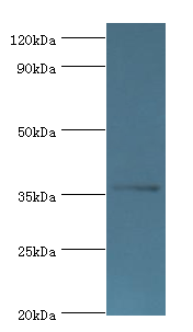 AKR1B10 Antibody - Western blot. All lanes: Aldo-keto reductase family 1 member B10 antibody at 4 ug/ml+A549 whole cell lysate. Secondary antibody: Goat polyclonal to rabbit at 1:10000 dilution. Predicted band size: 36 kDa. Observed band size: 36 kDa Immunohistochemistry.