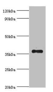 AKR1B10 Antibody - Western blot All lanes: AKR1B10 antibody at 4µg/ml + A549 whole cell lysate Secondary Goat polyclonal to rabbit IgG at 1/10000 dilution Predicted band size: 36 kDa Observed band size: 36 kDa