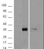 AKR1B10 Antibody - HEK293 overexpressing AKR1B10 (RC203177) with C-terminal tag (DYKDDDDK) and probed with anti-DYKDDDDK in the left panel and with in the right panel (mock transfection in first and last lanes).