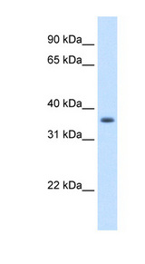 AKR1B10 Antibody - AKR1B10 antibody ARP42553_T100-NP_064695-AKR1B10(aldo-keto reductase family 1, member B10 (aldose reductase)) Antibody Western blot of A549 cell lysate.  This image was taken for the unconjugated form of this product. Other forms have not been tested.