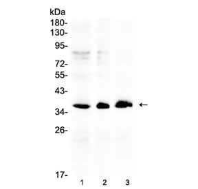 AKR1B10 Antibody - Western blot testing of human 1) HeLa, 2) COLO320 and 3) SW620 cell lysate with AKR1B10 antibody at 0.5ug/ml. Predicted molecular weight ~36 kDa.