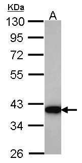 AKR1C4 / Chlordecone Reductase Antibody - Sample (30 ug of whole cell lysate). A: Hela. 10% SDS PAGE. HSD3a antibody. AKR1C4 antibody diluted at 1:1000.